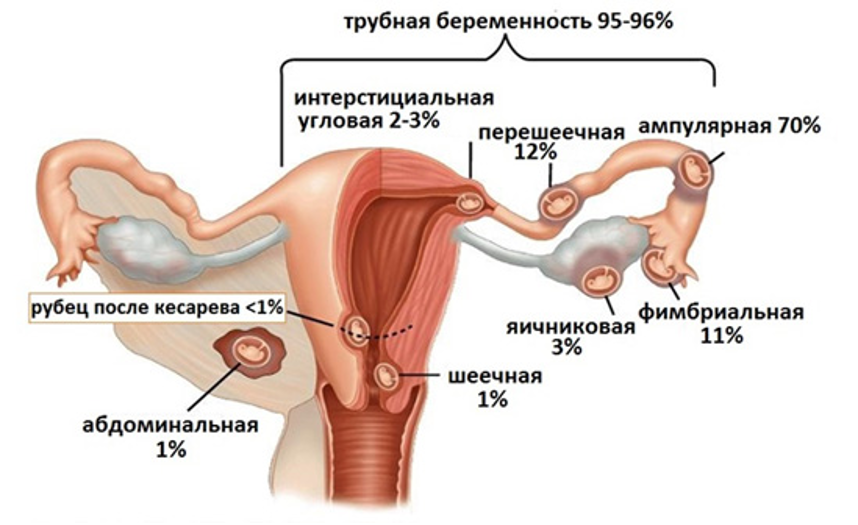 график1.png